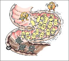 喝酸奶能缓解慢性胃炎吗,喝酸奶能预防肝性脑病吗