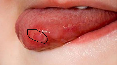 舌头别舔这里,小动作却会诱发大疾病!