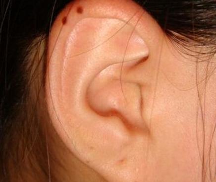 女人四个部位长痣一生富贵,相学中女人眼下长黑痣解法