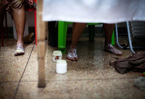 非洲人以白为美？花重金全身漂白比整容还疯狂！