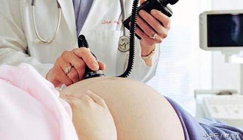 产检胎心率150以上,胎心昨天超过160今天120