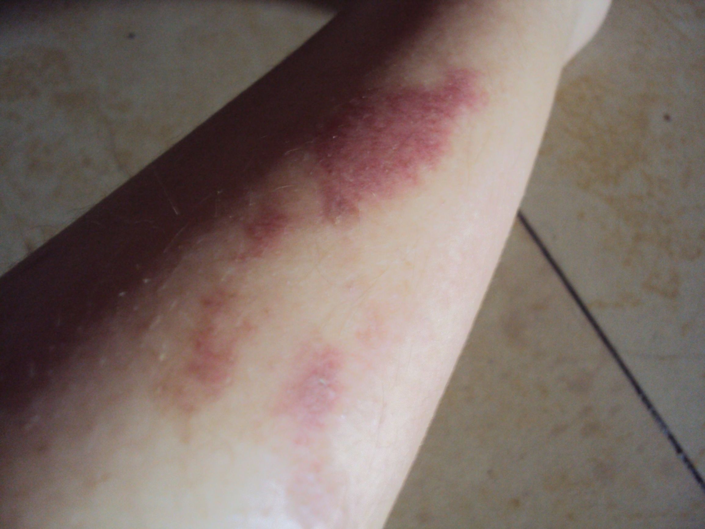 蛋黄油，不仅是烧烫伤妙药，还能治1种男人的难言之隐