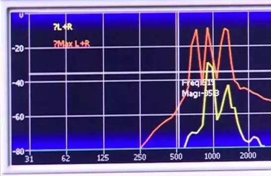 谁说动漫都是骗人的！柯南里用人声音拨号真的可以打通电话！