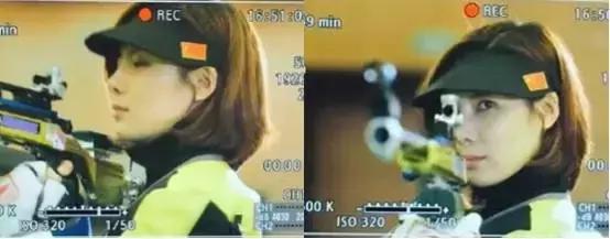 奥运冠军也爱美瘦脸箍牙后她们都美啦