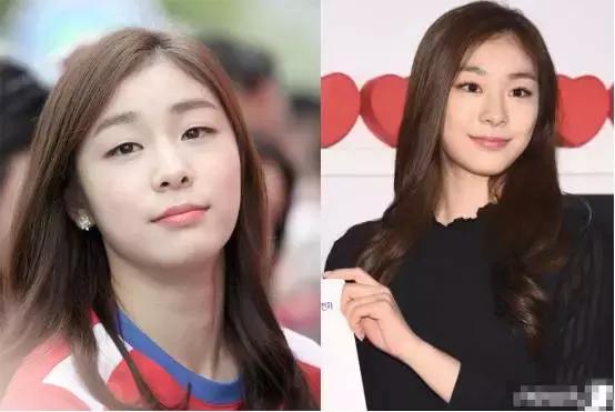 奥运冠军也爱美瘦脸箍牙后她们都美啦