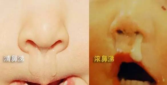 为什么喝感冒药越喝越严重,吃感冒药的六个小常识