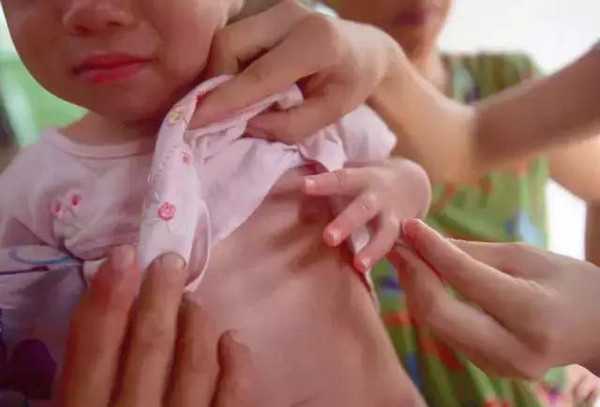 6岁孩子胸部开始发育？妈妈这样的恶习伤害的不仅仅是眼睛！