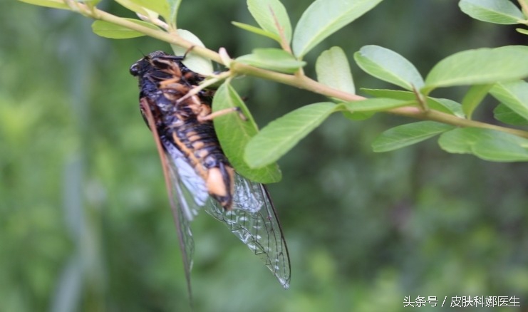 荨麻疹草药治疗法,中药治荨麻疹的最好方法