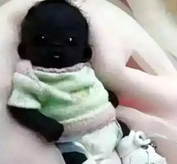 做b超宝宝好丑,做b超宝宝跪着视频