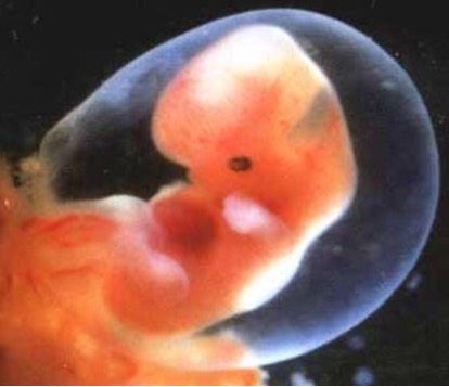 胎停育还有救吗,有胎停育的征兆能救回来吗