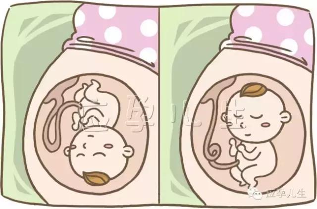 孕妈看过来,分娩前可能出现这些突发状况