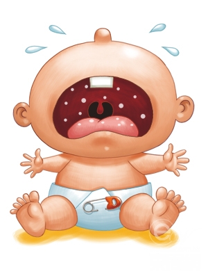 鹅口疮是什么颜色的,鹅口疮是什么颜色