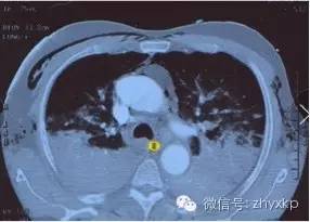 呼吸机不加热了,呼吸机不加热