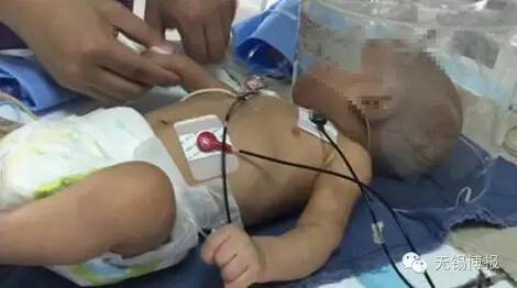 心痛！江阴3个月大男婴嘴部严重烫伤、腿部有牙印、肋骨骨折！这是一个怎样的家啊