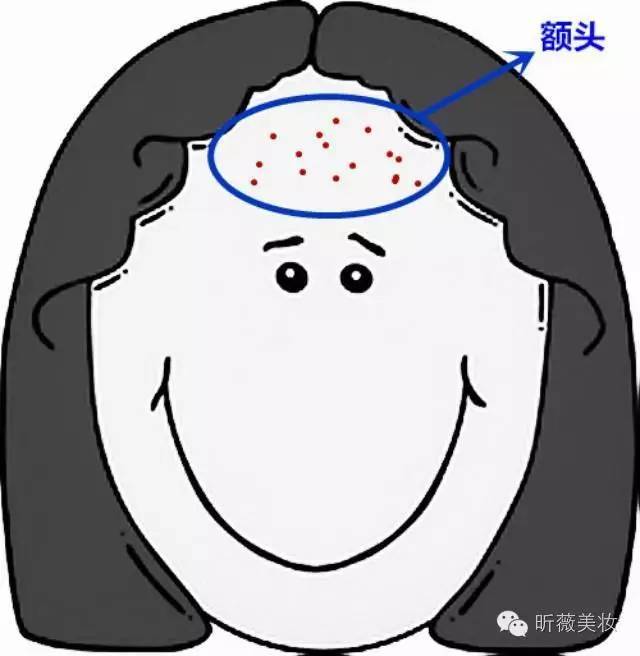 长痘不止青春期全年龄战痘,健康长痘不止青春期全年龄战痘