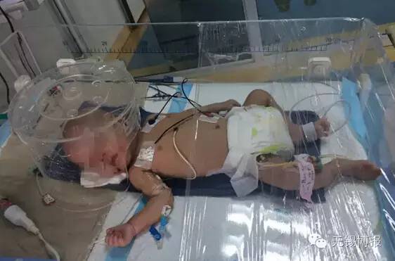 心痛！江阴3个月大男婴嘴部严重烫伤、腿部有牙印、肋骨骨折！这是一个怎样的家啊