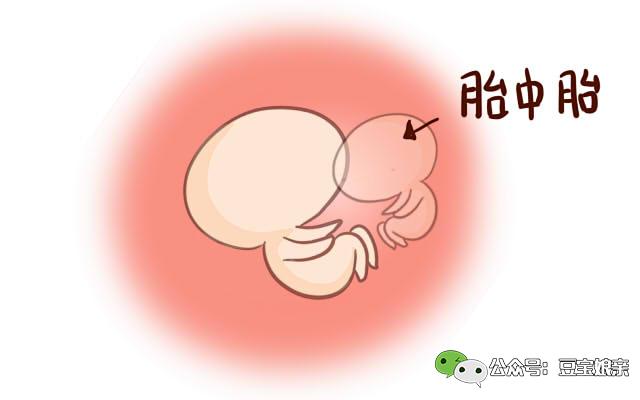 3岁女童患怪病肚子大如球,五岁女童肚子大手术之后令人震惊