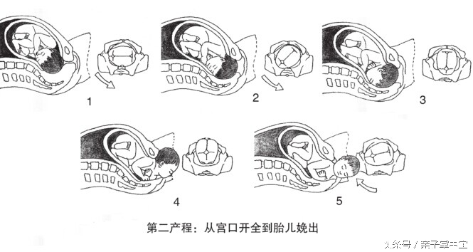 产妇注意了！分娩时生的太快，对新生儿有害！