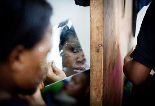 非洲人以白为美？花重金全身漂白比整容还疯狂！