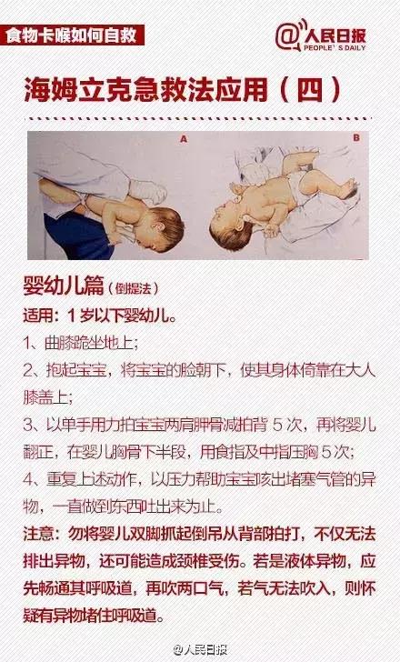 女孩被龙眼卡喉医生合力救回,小孩被荔枝卡喉咙急救