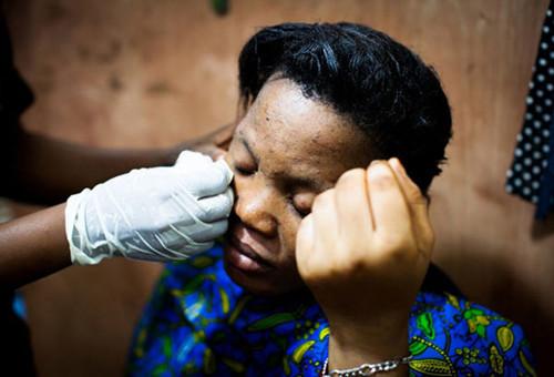 非洲人以白为美？花重金全身漂白比整容还疯狂！