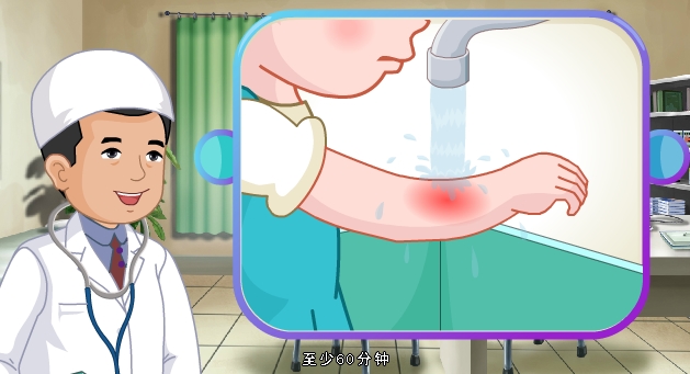 孩子烫伤怎么办视频,被油烫伤的孩子