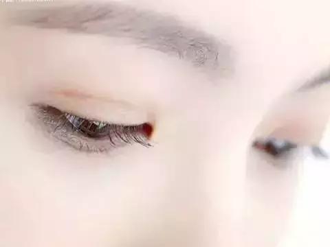 一对双眼皮挽救一张脸,做完双眼皮怎么护理恢复得快