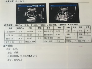 排畸检查能看到孩子脸吗,排畸检查是在怀孕几个月