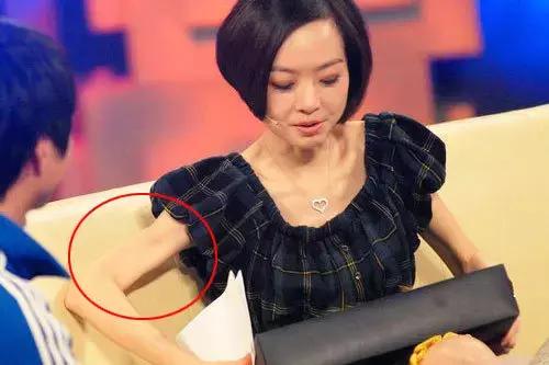 颖儿的胸骨突出,颖儿胸骨突出