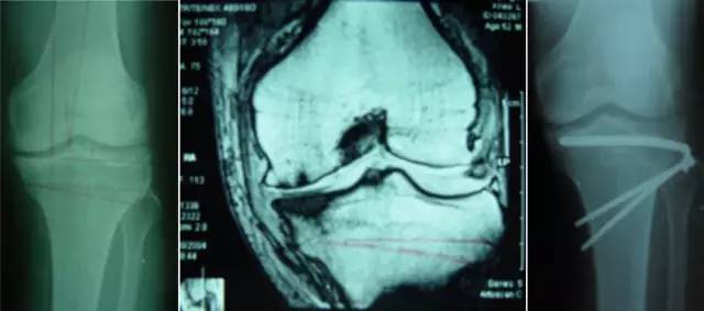 杏林秋实清华长庚骨科·关节外科中心