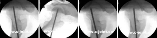 杏林秋实清华长庚骨科·关节外科中心