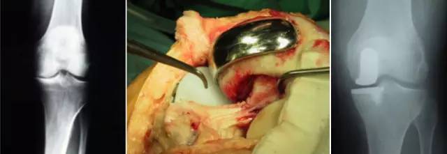 杏林秋实清华长庚骨科·关节外科中心