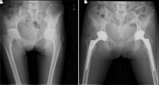 杏林秋实清华长庚骨科·关节外科中心