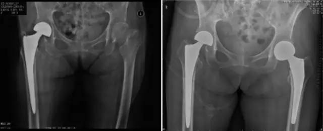 杏林秋实清华长庚骨科·关节外科中心