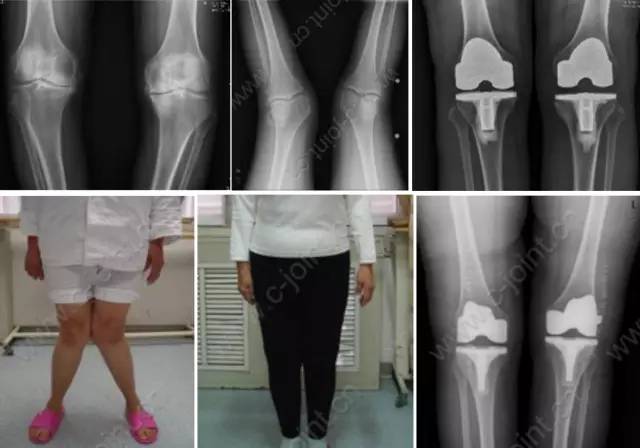 杏林秋实清华长庚骨科·关节外科中心