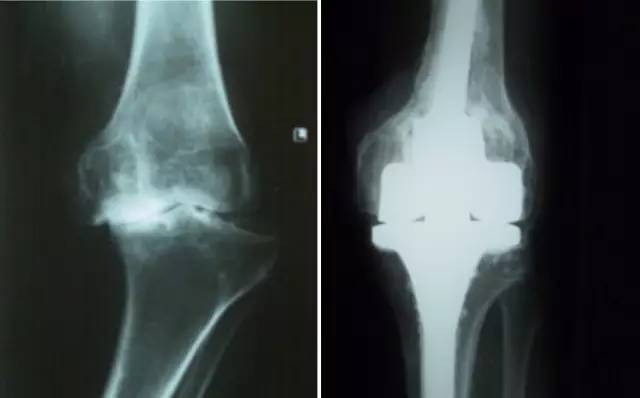 杏林秋实清华长庚骨科·关节外科中心