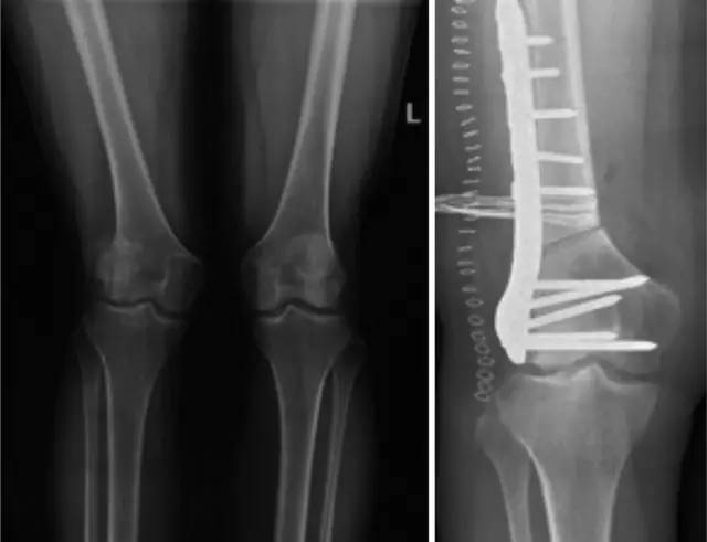 杏林秋实清华长庚骨科·关节外科中心