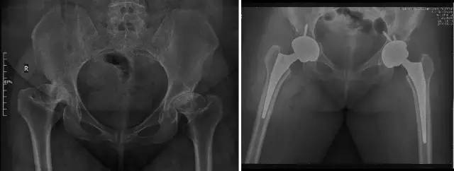 杏林秋实清华长庚骨科·关节外科中心