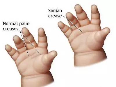 精准医学的本质是什么,精准医学有什么功效