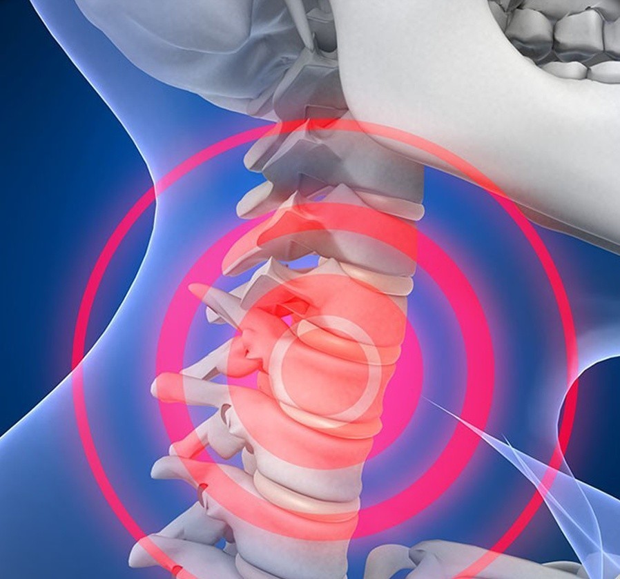 后仰可以改善驼背吗,后仰可以治颈椎病吗