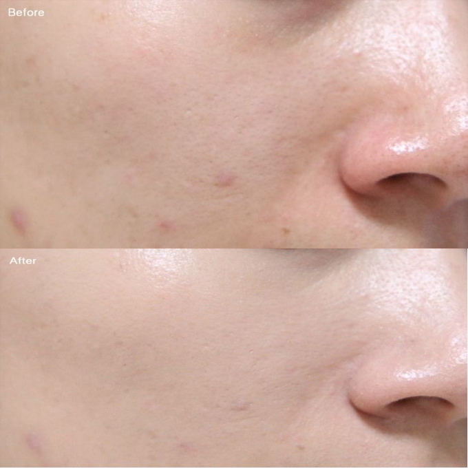 这个牌子完爆贝德玛堪比植村秀,你却还不知道