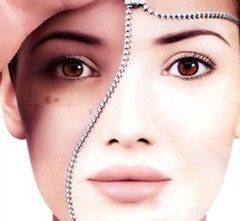 祛斑的小妙招有哪些,真实有效的祛斑小妙招