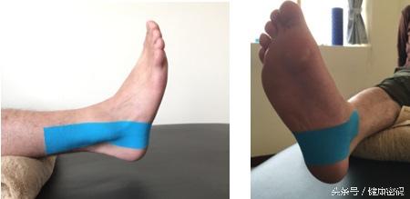 脚踝扭伤了不能走路怎么恢复最快,脚踝扭伤影响运动功能吗