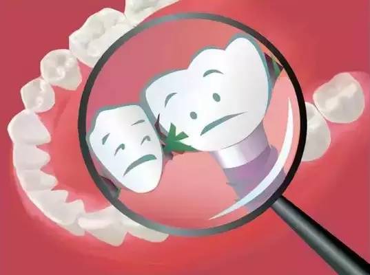 一吃东西就塞牙有什么好办法,怎样防止食物塞牙