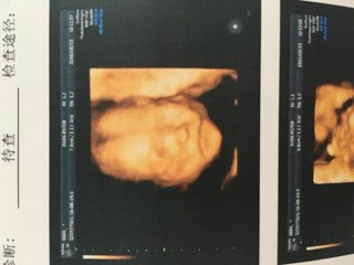 四维终于顺利通过了3次,四维顺利通过但是胎动还是不明显