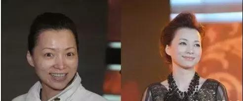 毛孔粗大怎么消除,毛孔粗大怎么消除最有效