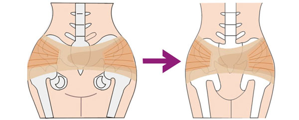 揭秘顺产有多痛,顺产的秘密后续