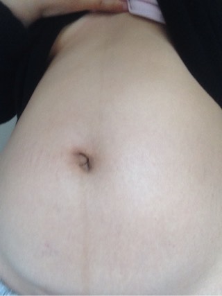 因为孩子畸形而引产,孩子没问题引产了心里真的不好受