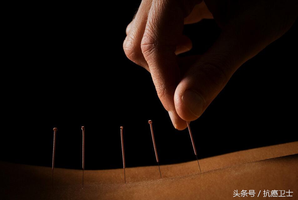 中医针灸理疗师证能针灸吗,中医针灸治疗癌症