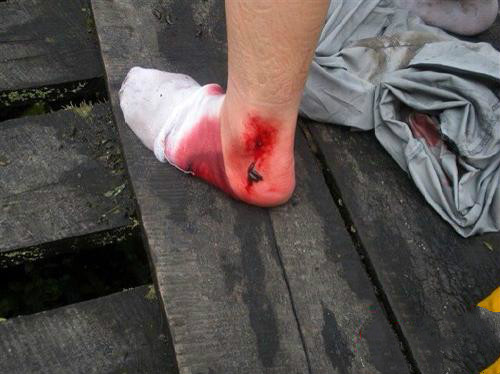 谁知道蚂蟥的药用价值,吸血蚂蟥有4大功效